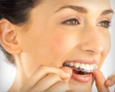 Patients from Hillcrest - downtown San Diego are asking what is Invisalign invisible braces?